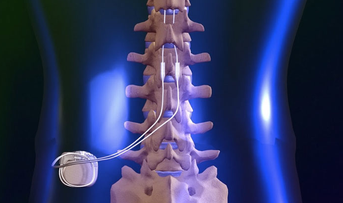 coastal-orthopedics-doctor-a-leader-for-new-spinal-cord-study